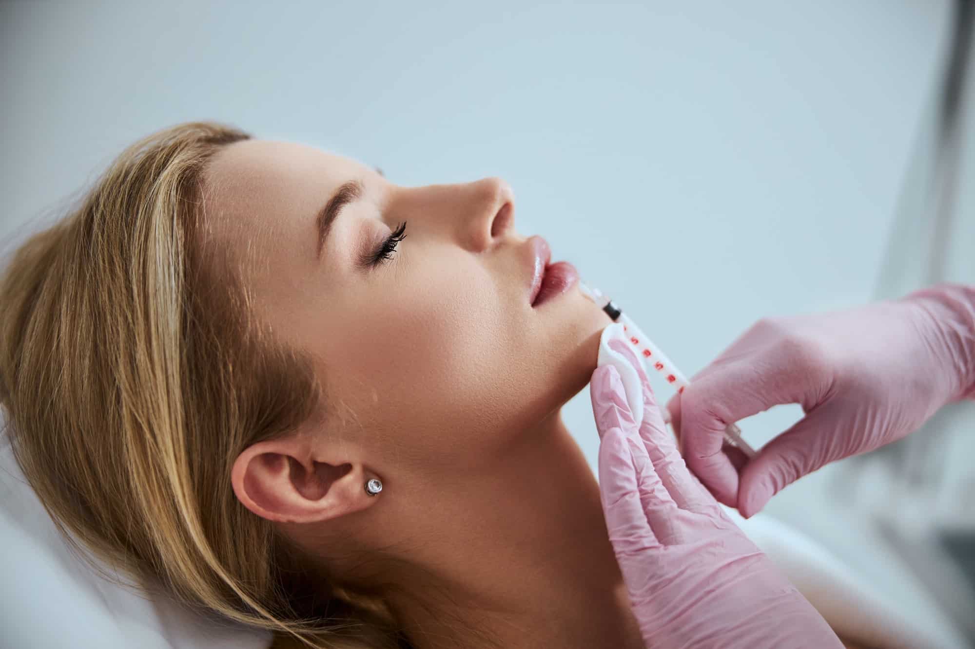 lip fillers