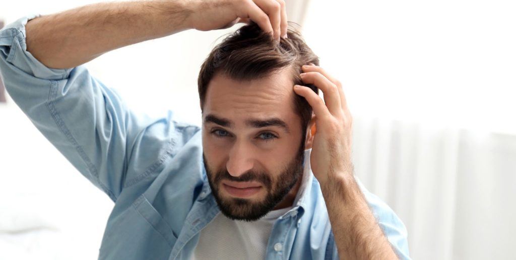 Bilde av mann som stresser over hårtap.