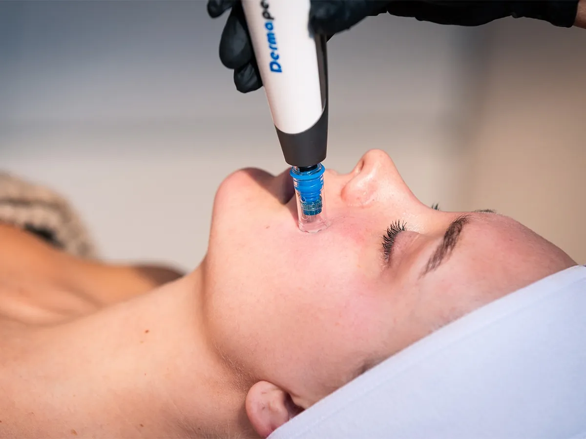Dermapen