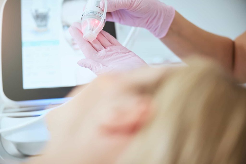 Hudlege forbereder pasienten for en microneedling behandling