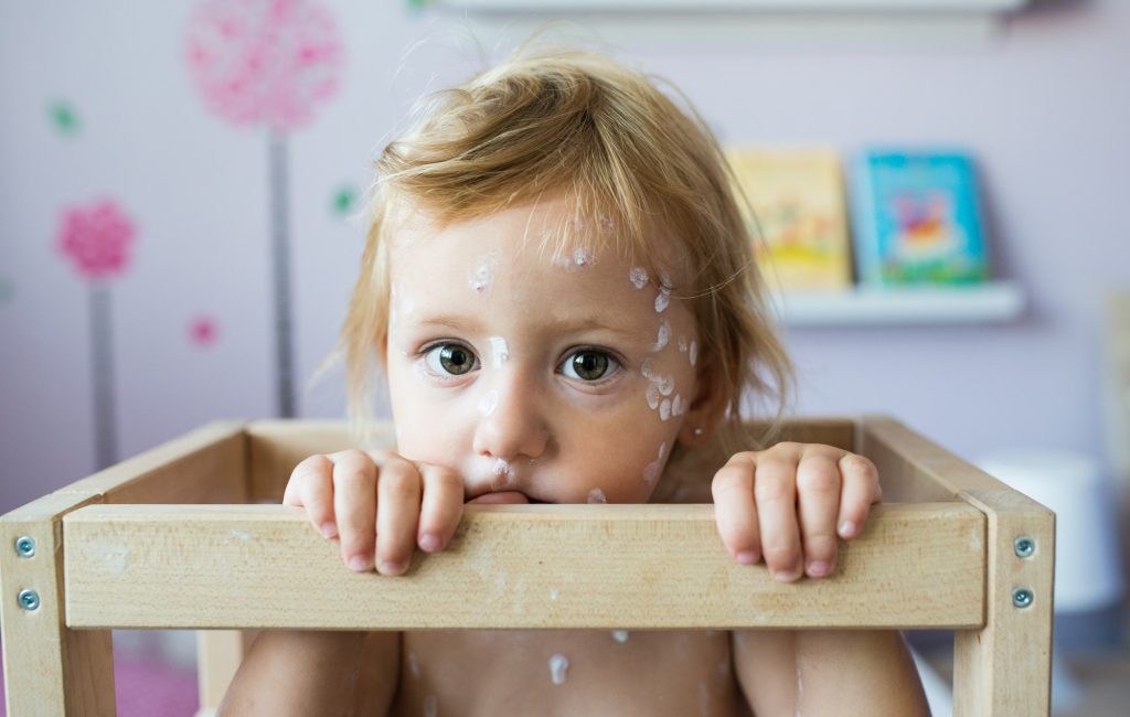 Little girl with chickenpox, sitting in wooden chair