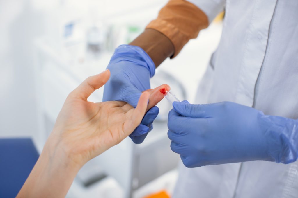 Afroamerikansk helsearbeider gjør en fingerstikktest for HIV.