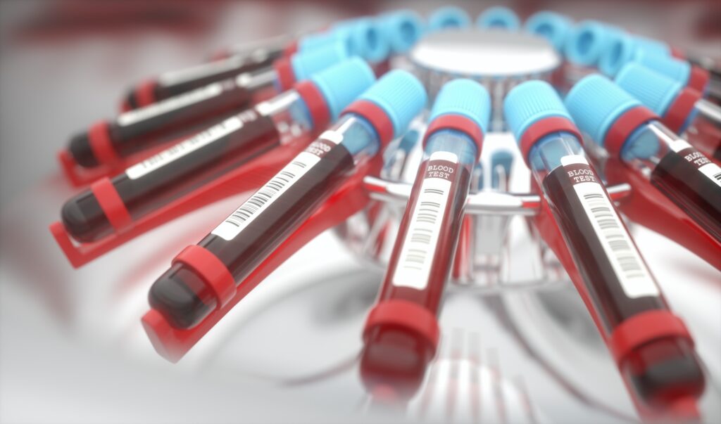 Blood Centrifuge Machine