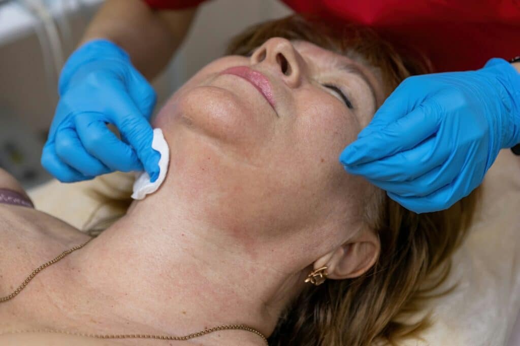 Carboxytherapy of fat deposits on the chin. Rejuvenation of the facial skin with carbon dioxide. Cor