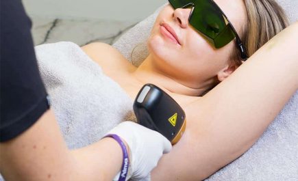 Dame får laser hårfjerning hos Velbehag Klinikk Kristiansand